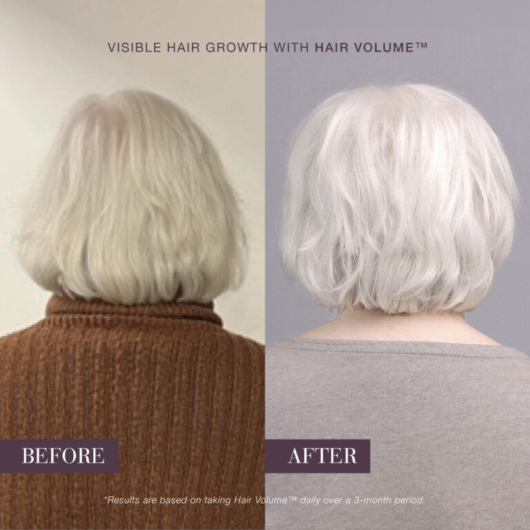 Matu stāvoklis pirms un pēc lietošanas — pēc New Nordic Hair Volume™ lietošanas mati izskatās apjomīgāki un spīdīgāki.