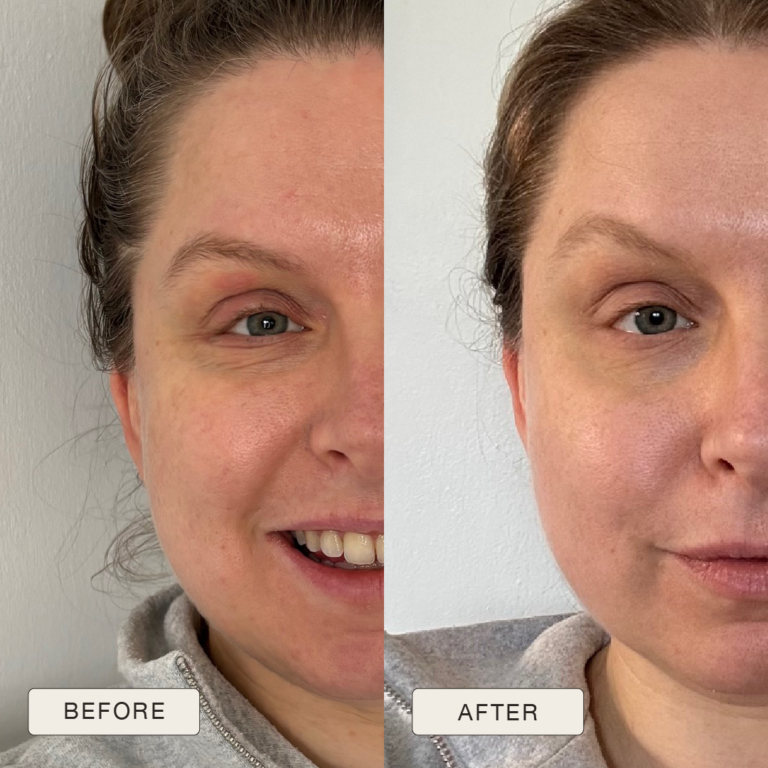 Lauras atsauksme, fotogrāfijas „pirms” un „pēc” pēc „Natural Magic” ādas kopšanas produktu lietošanas